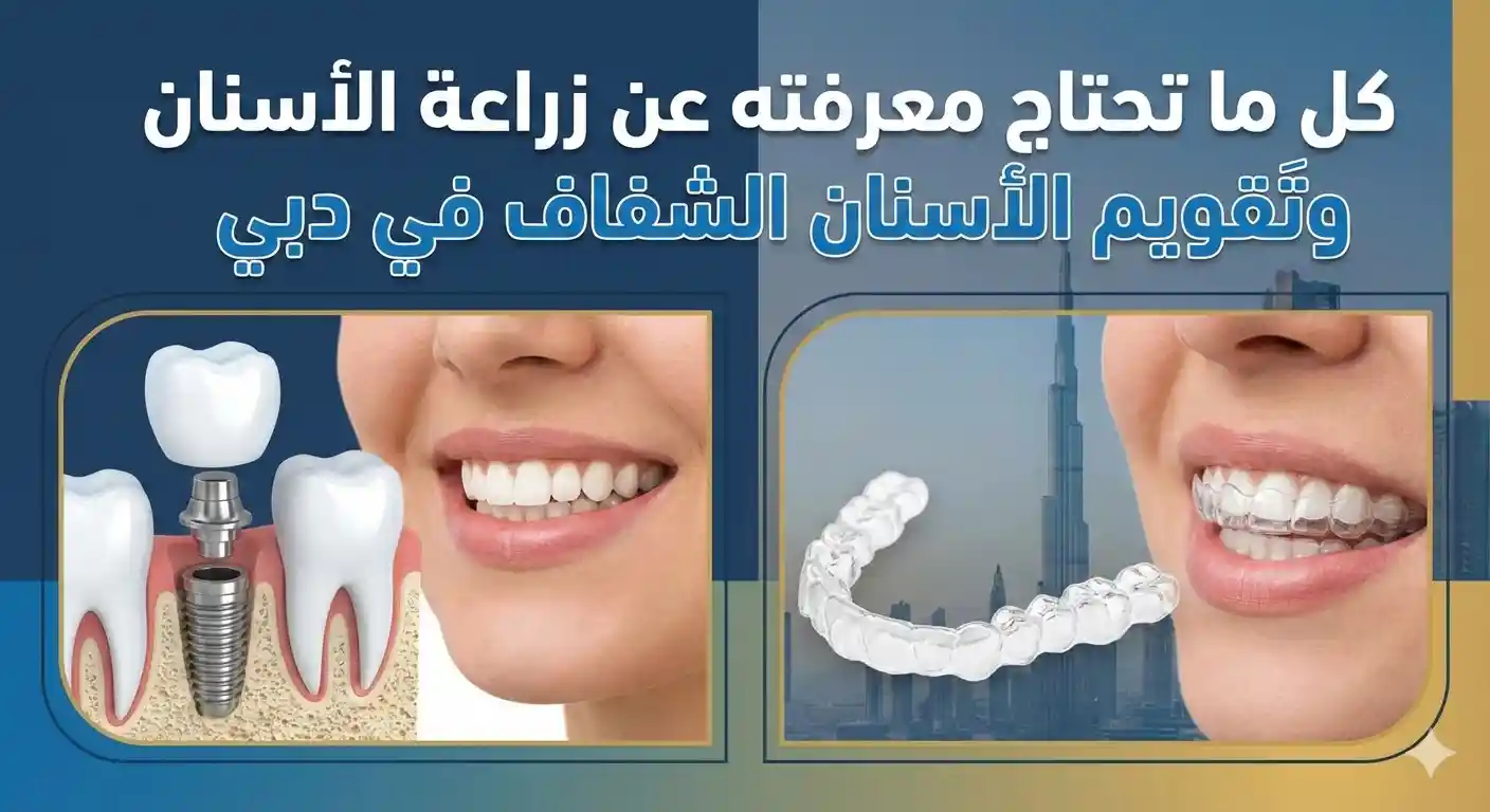 كل ما تحتاج معرفته عن زراعة الأسنان وتَقويم الأسنان الشفاف في دبي